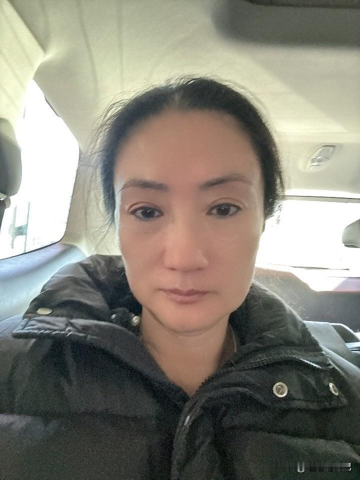 超姐正面照曝光，60岁的她，为了美，可以被扎几十针。
这是打完除皱针的样子，仔细