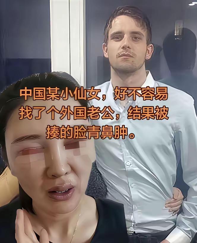 当初为了嫁给个老外，一分钱财礼都不要，三金，改口费什么的连提都不敢提，甚至倒贴着