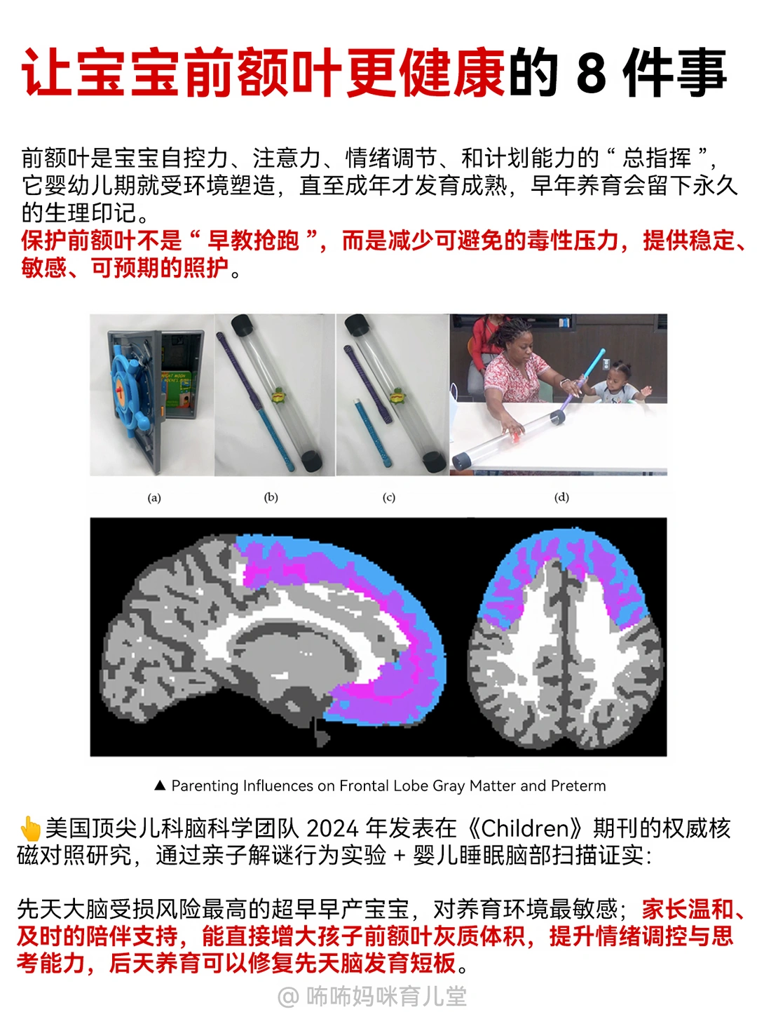 别瞎早教❗育儿顶级内卷是养好宝宝前额叶