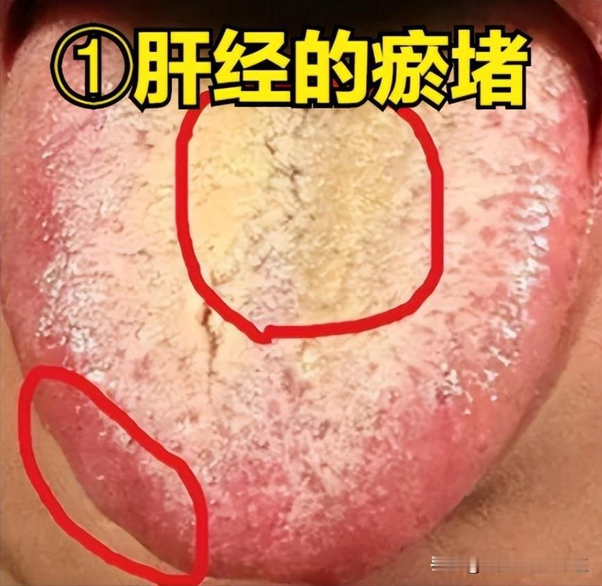 宗筋无力，抬不起头，除了肾虚，还会是这几个地方堵了！

1、肝经淤堵
原因：肝经