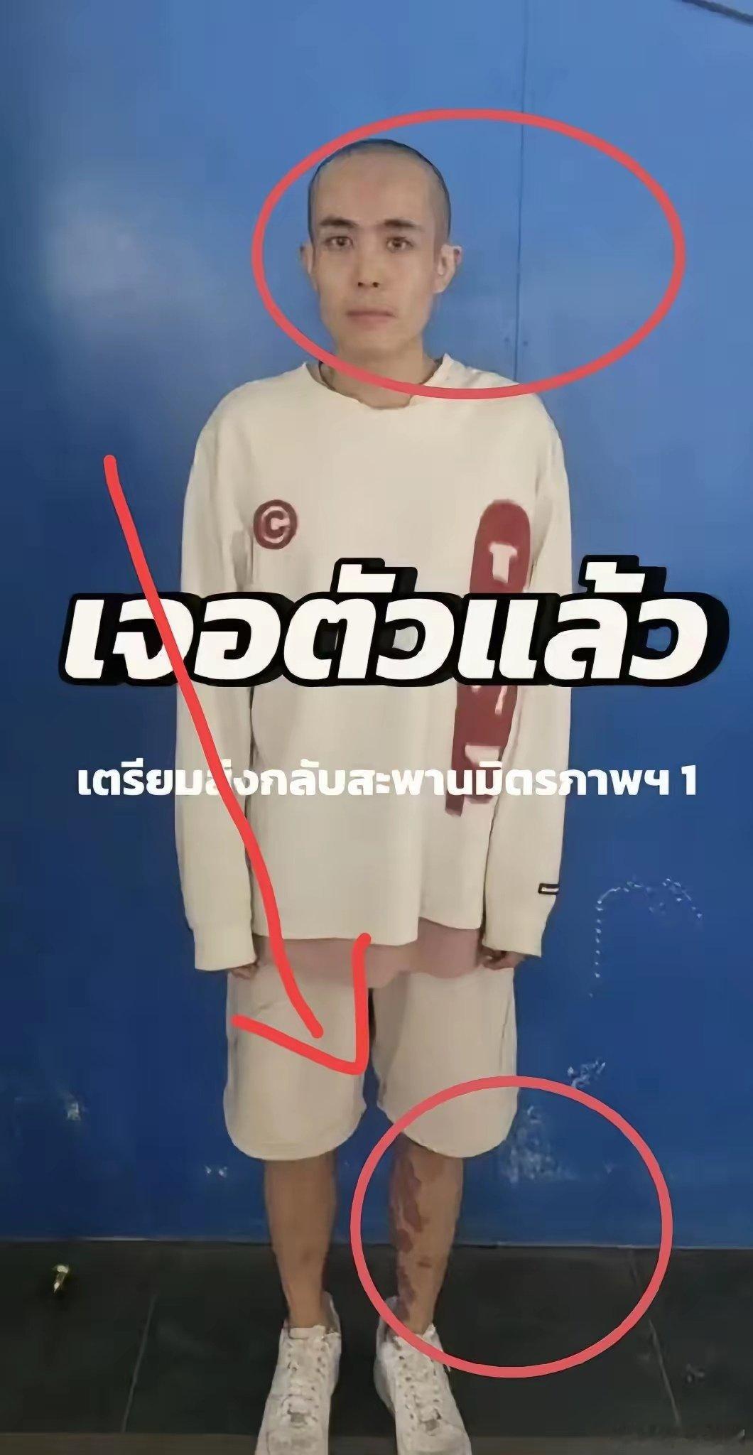 演员王星被找到，我发现了三个让人害怕的小细节。1.头发被剃光听说去了那里需要把头