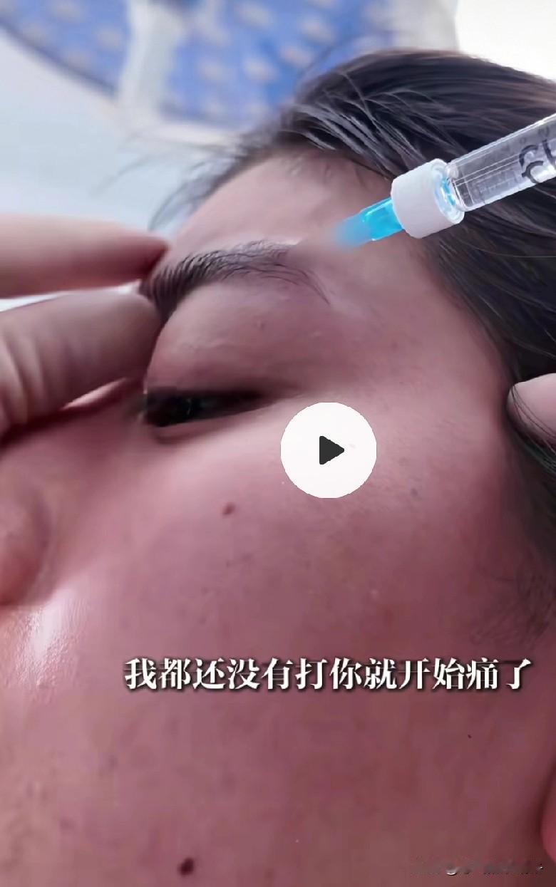 眉骨打一针，耳朵打一针，嘴巴打一针！看着都好疼好疼😣这美容针打的也太吓人了吧！