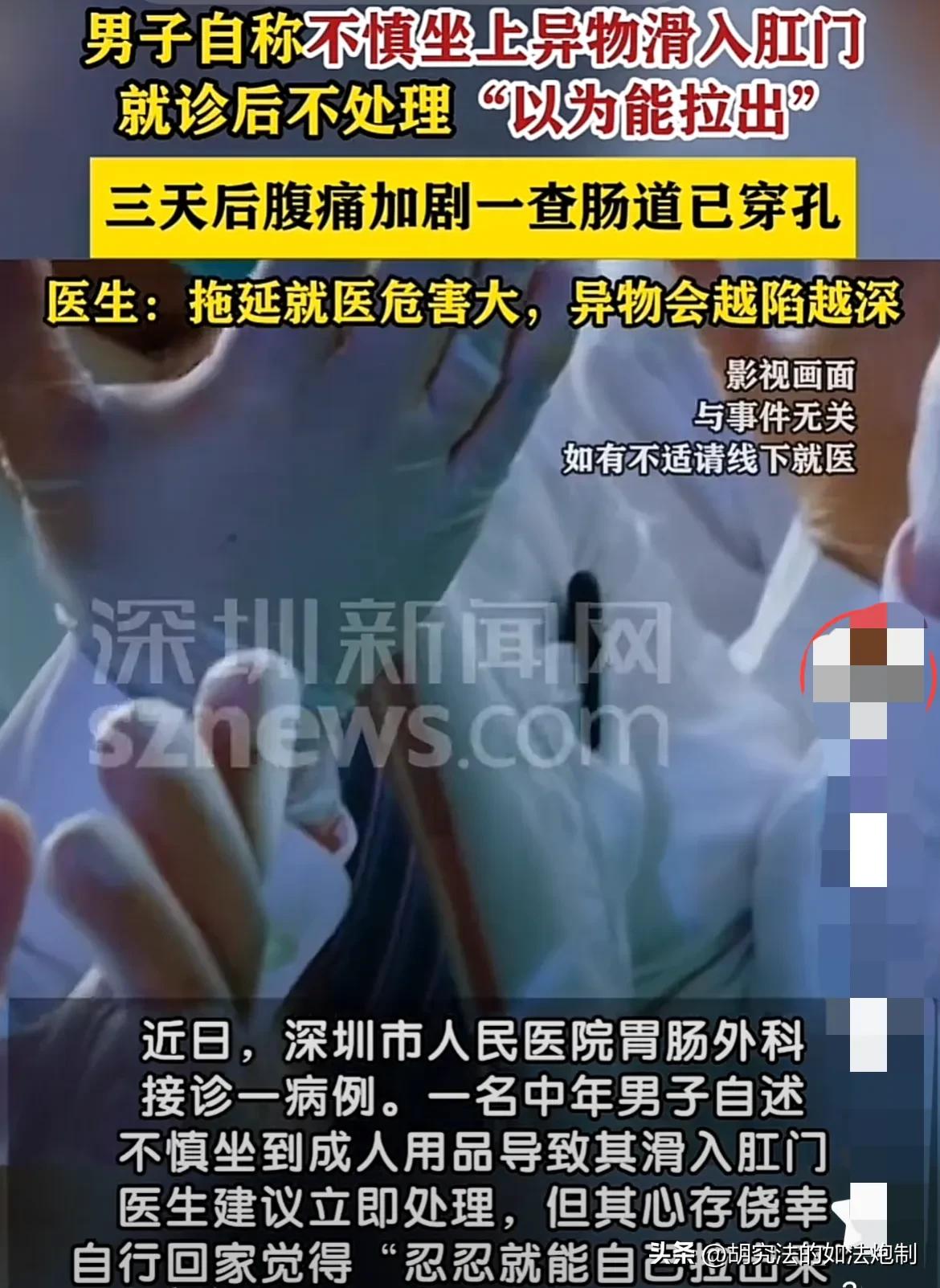 捏了把汗！广东深圳，一男子不慎坐上y物，导致y物进入体内。男子赶紧去医院检查，医