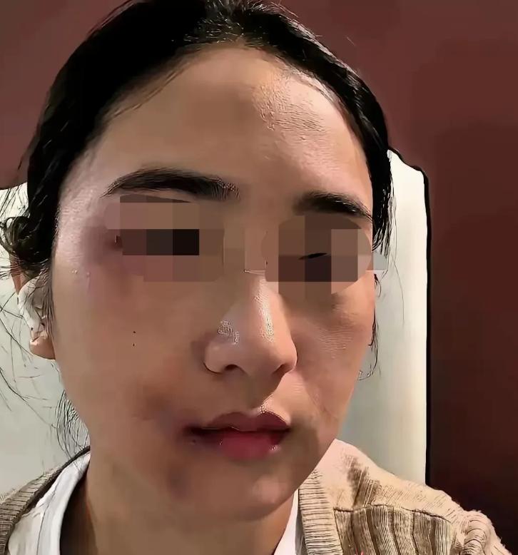 丈夫家暴妻子近十年，刚动手打完妻子三天，自己就确诊肝癌晚期，家人逼迫女方拿出全部