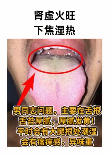 舌象里藏着体质密码，这三种情况要分清