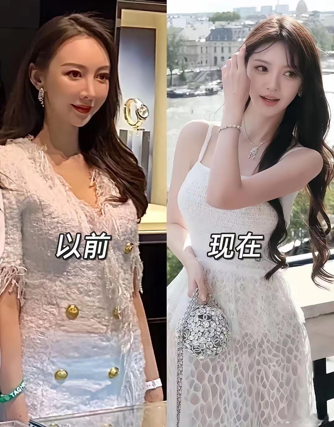 叶珂应该做过，整过 ​​​