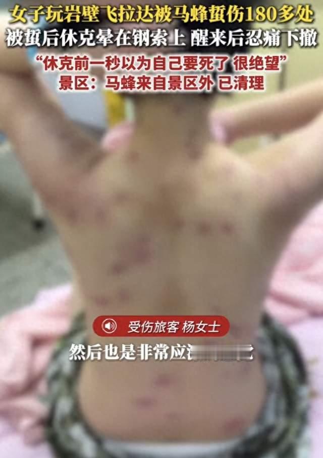 180多处蜂蜇倒在钢索上，淄博飞拉达项目赔偿谈不拢