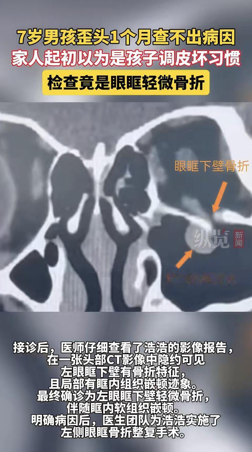 7岁男孩浩浩突然迷上了"歪脖子"，上课歪，写作业歪，怎么都改不掉。老师提醒，爸妈