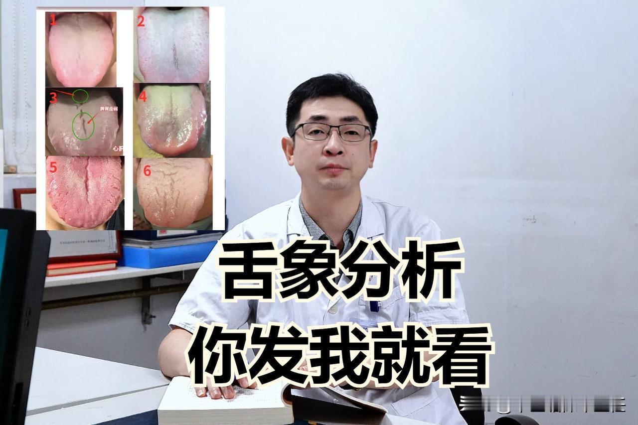 今日挑战全网收集100个舌象，你发舌头，我来分析！

注意拍舌头照片需要注意的事