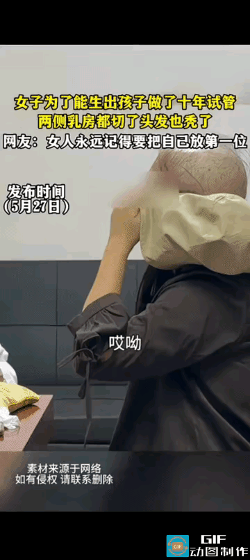 震惊了：一女子为了生孩子10年做了5次试管婴儿，最终两侧乳房都切了，头发也掉光了