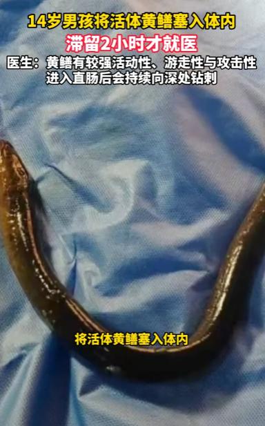 河南商丘，一14岁男孩因好奇心驱使，竟自行将一条活体黄鳝塞入体内，由于活黄鳝在其