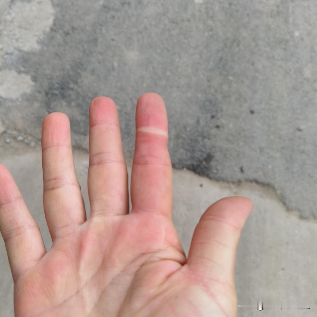 今天一大早提垃圾去扔。邻居阿姨说以为我去走亲戚，没想到是去扔垃圾。垃圾有点重，把