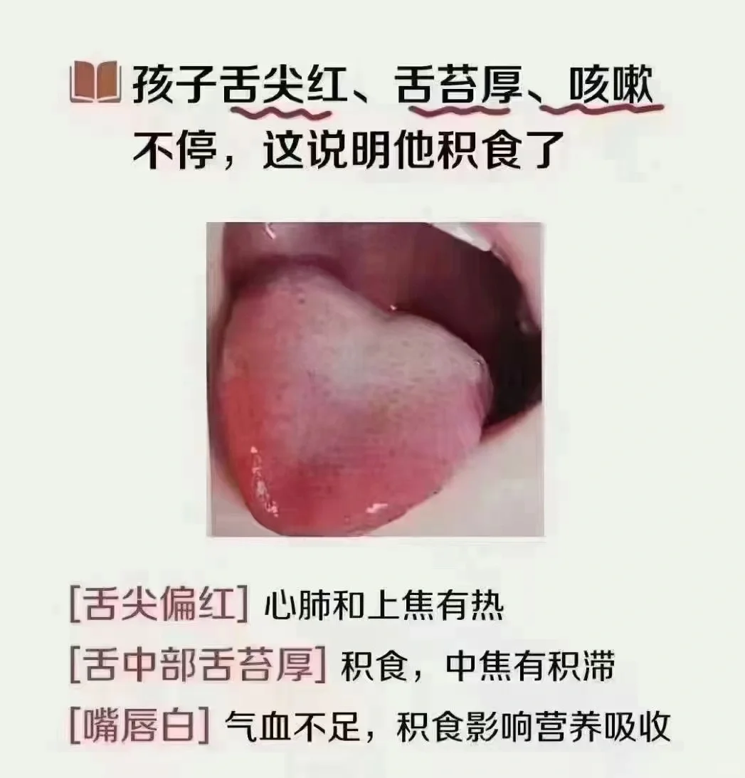 近期嗓子疼红肿的会较多尤其是内热重的孩子