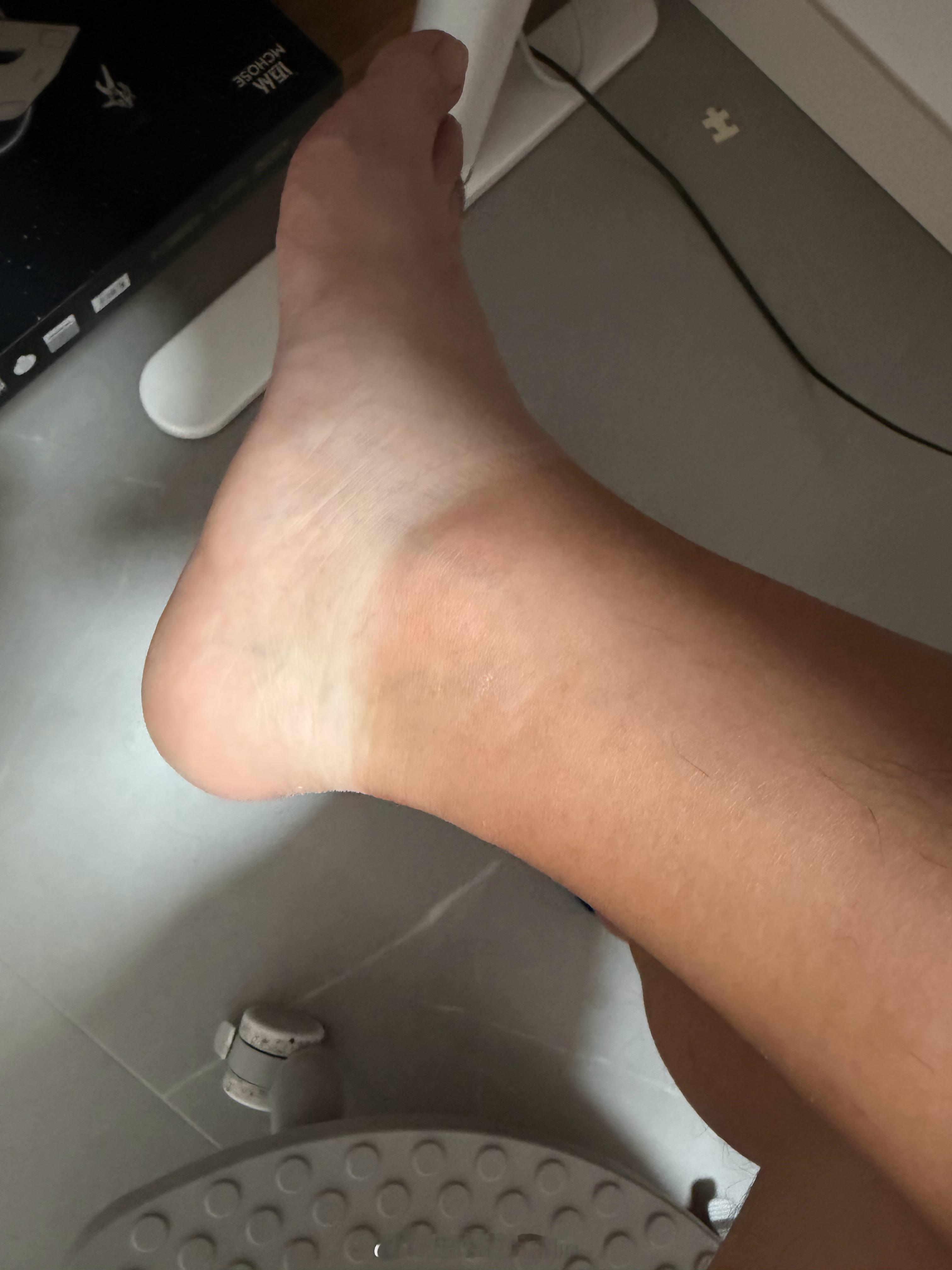 一个夏天没穿长裤更别提脸了，黑 