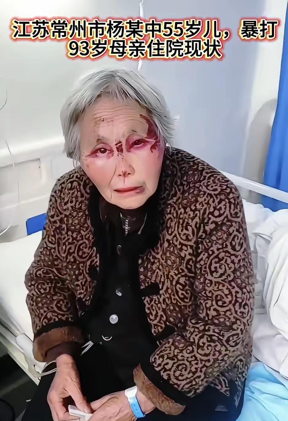 四个女儿一个儿子
本来应该安享晚年，谁知道摊上个不孝子。
儿子打她，脸都青了，看