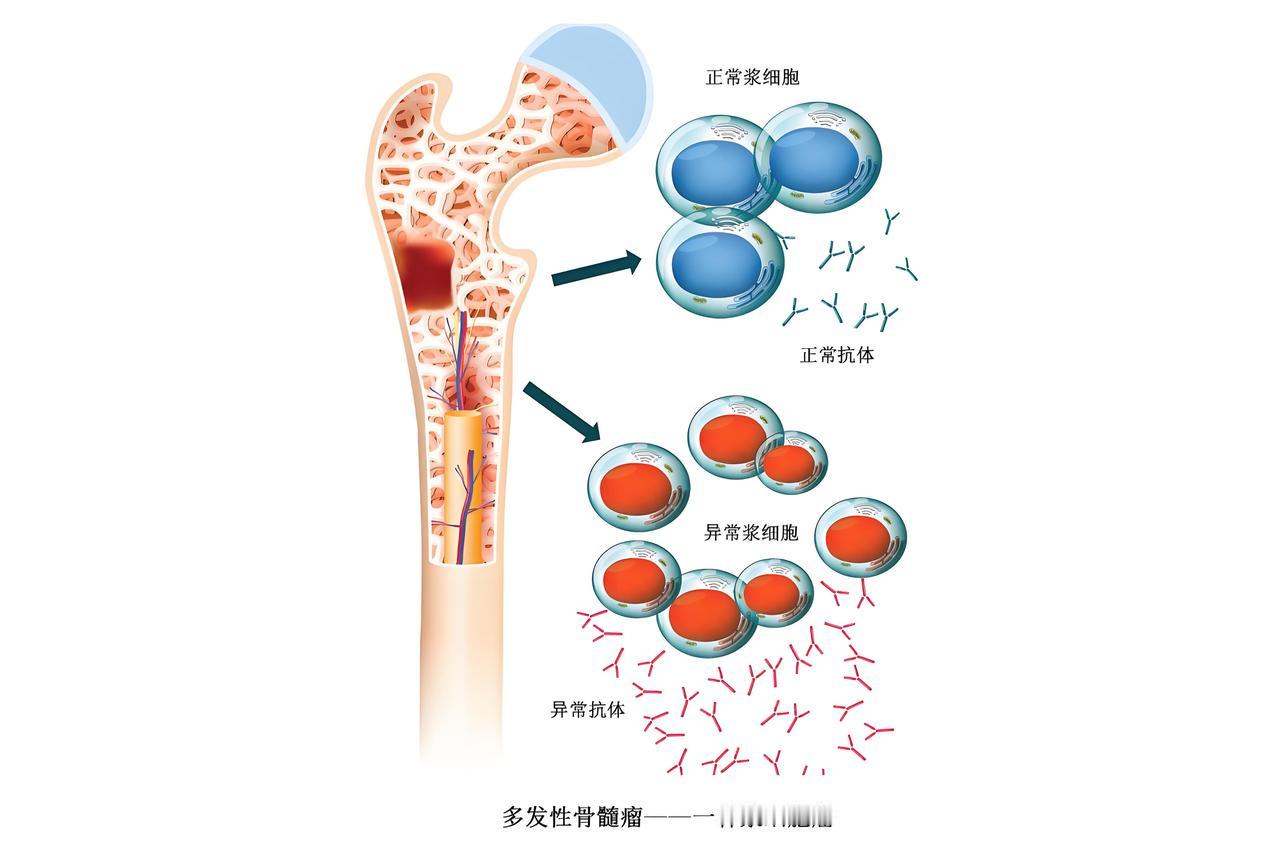 全身骨痛是什么病的前兆

全身骨痛可能是一些疾病的前兆，以下是一些常见可能性：