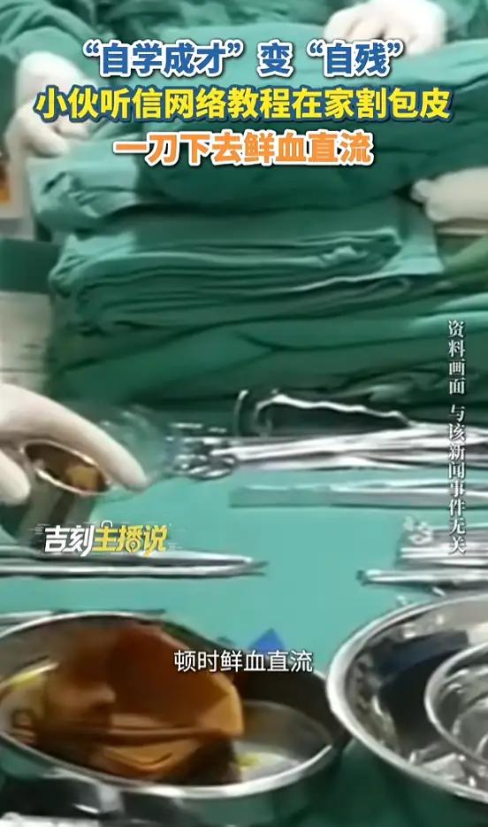 狠人！上海一小伙自学“裁缝”给自己割包皮，一刀下去直接红透半张床！网友：这得多大