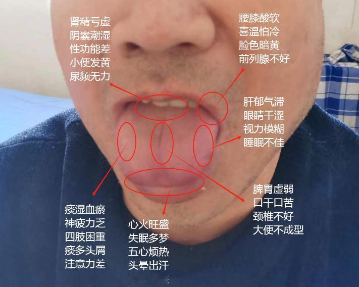 今日份患者舌象分析案例#中医健康##中医健康##辨舌象知健康#