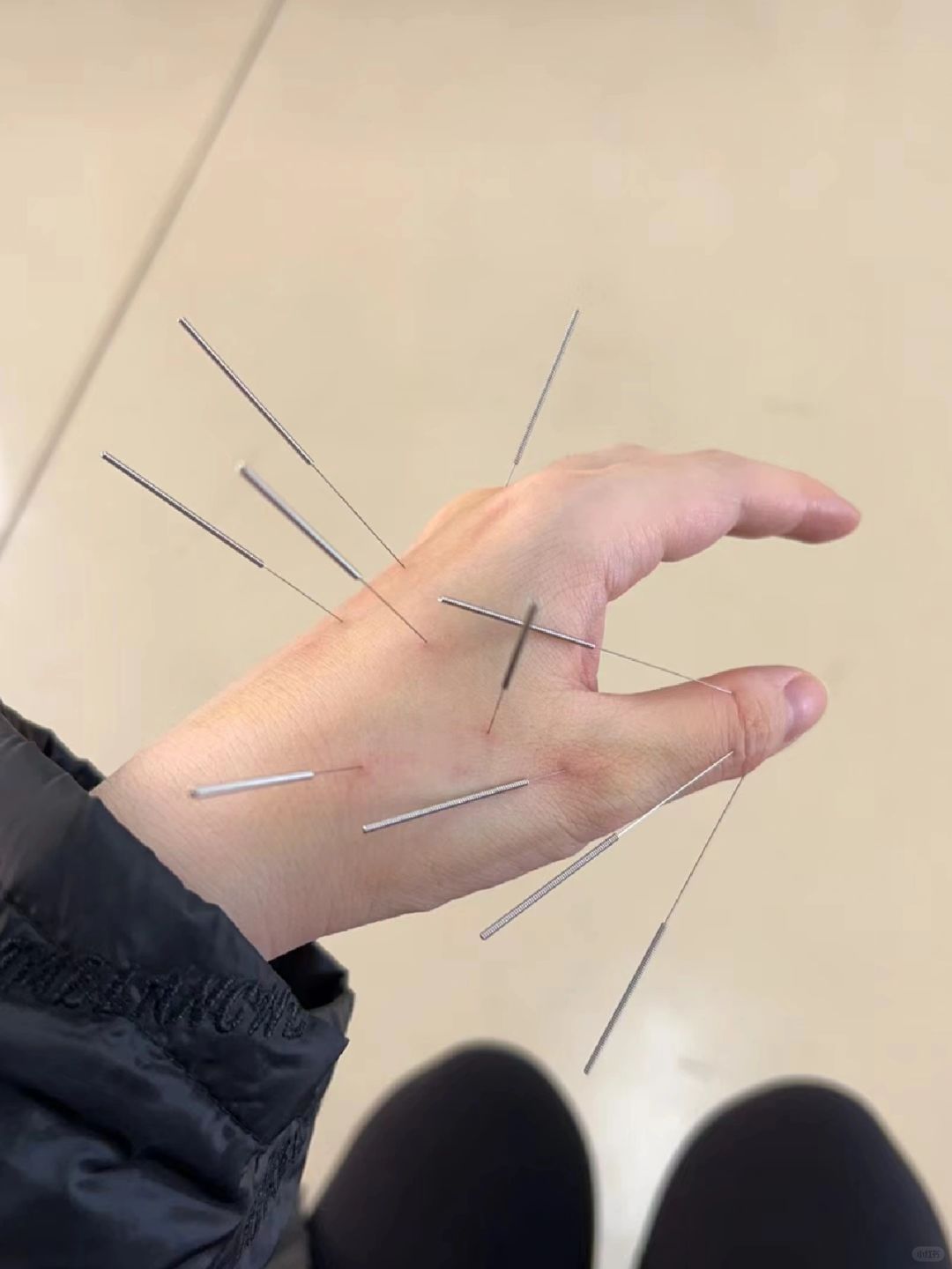 有和我一样产后三个月还没恢复气血的宝妈吗