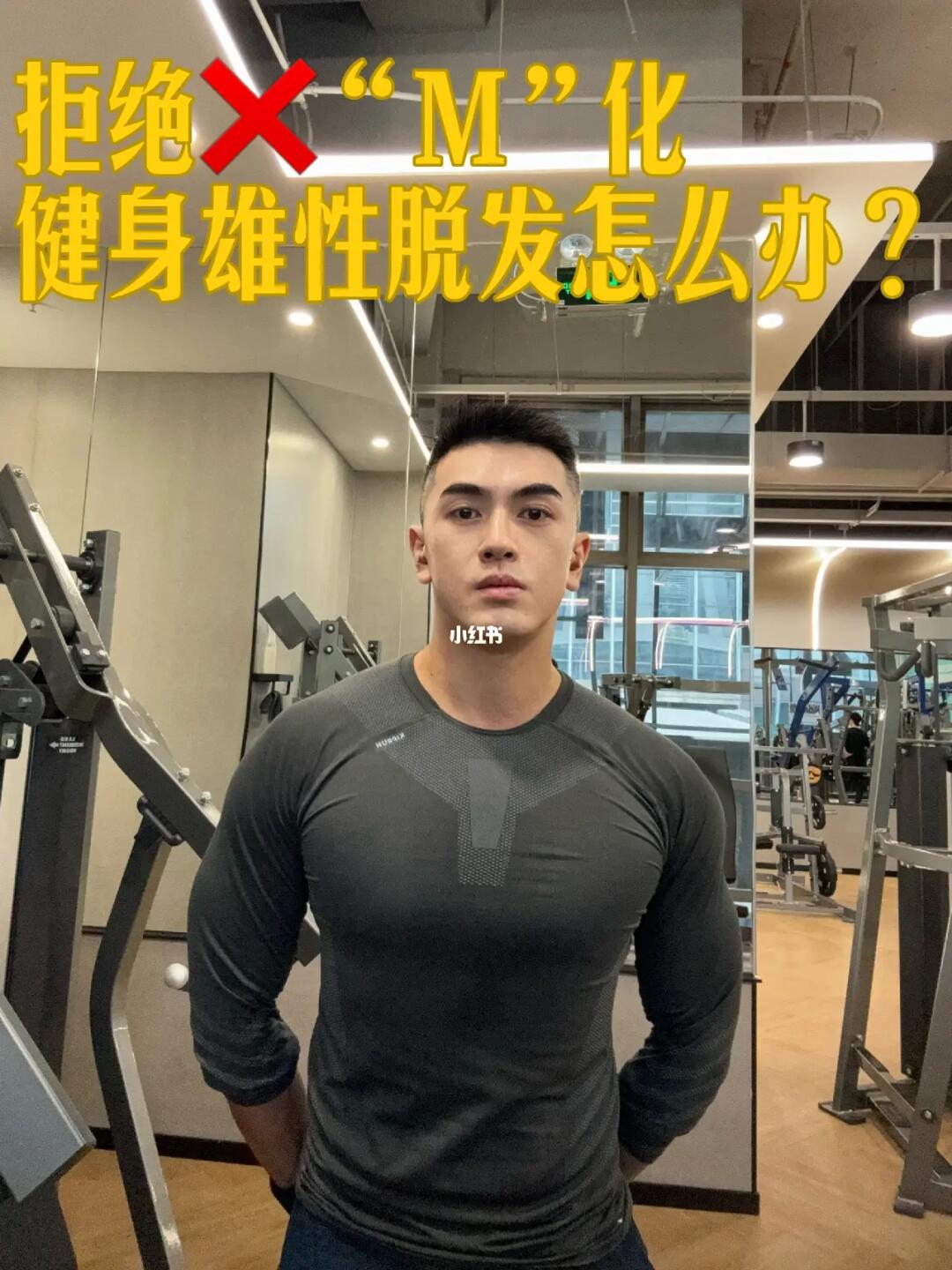 拒绝❌“M”化 健身雄性脱发怎么办？