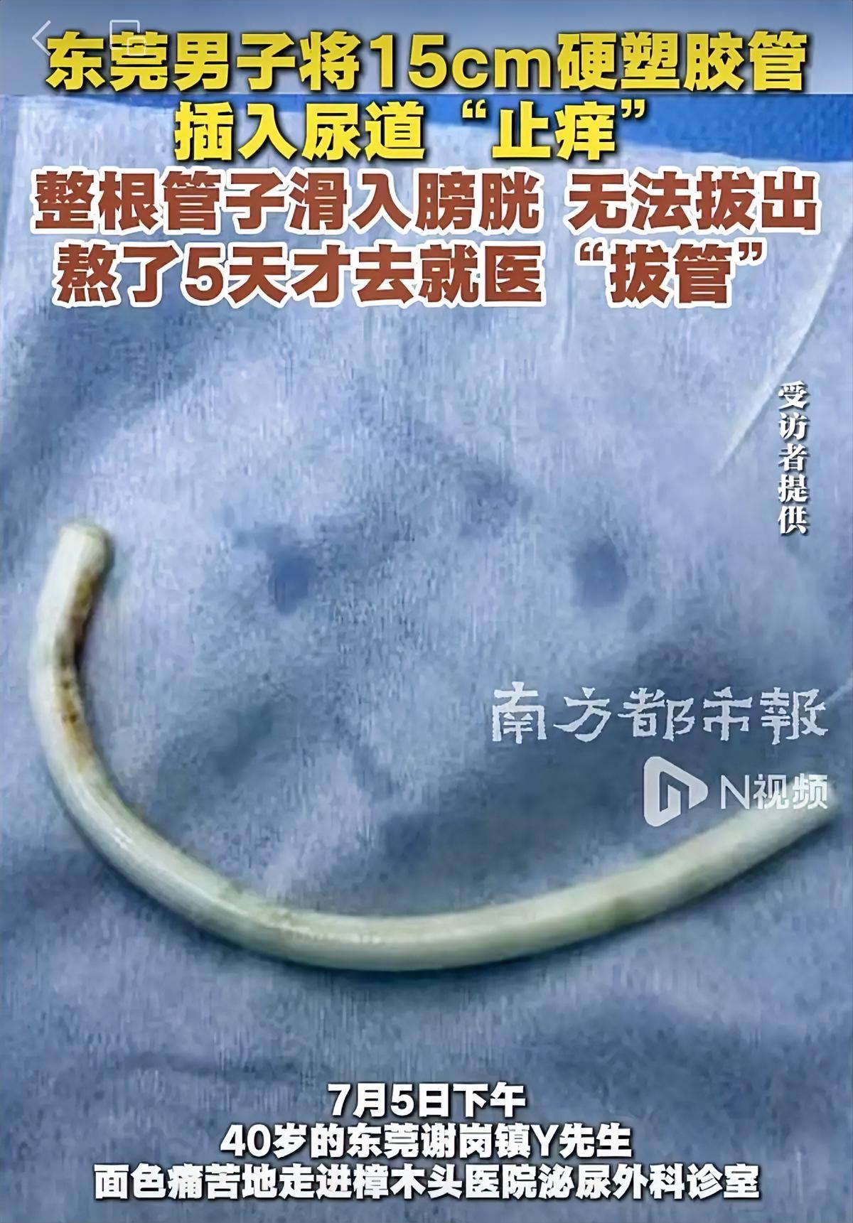 真的大开眼界
东莞这位大哥的操作看得人浑身发紧！尿道发痒不找医生，自己拿15厘米