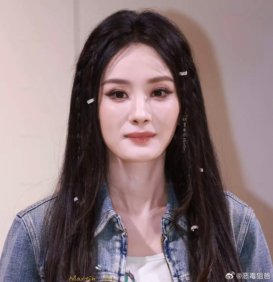 我🍯怎么越来越像三梦奇缘了早期拔牙削骨后遗症都出来了脸上肉挂不住 脸型也有点回