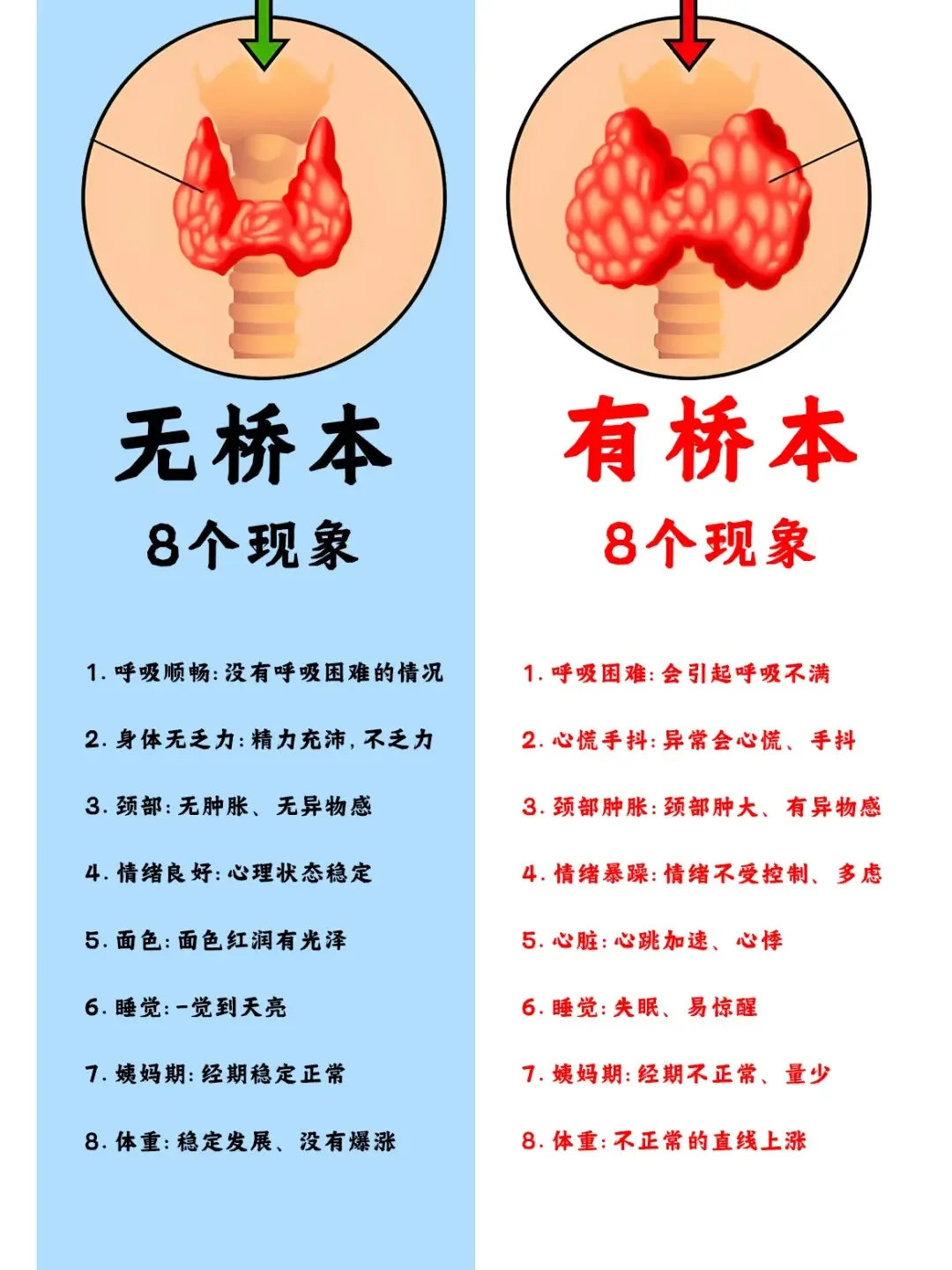 桥本氏甲状腺炎 健康科普