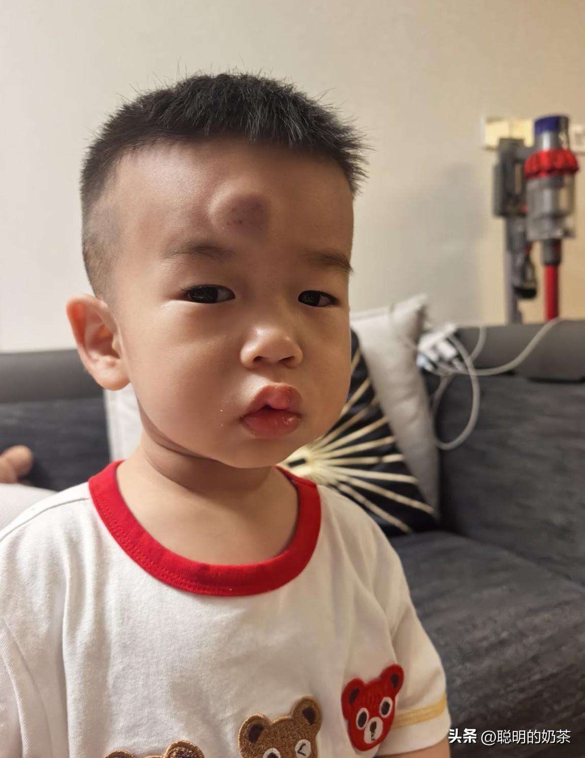 孩子只是告诉我被一只穿着黄色马甲的小飞虫亲了一下就这样了！听得我一头雾水，到底是