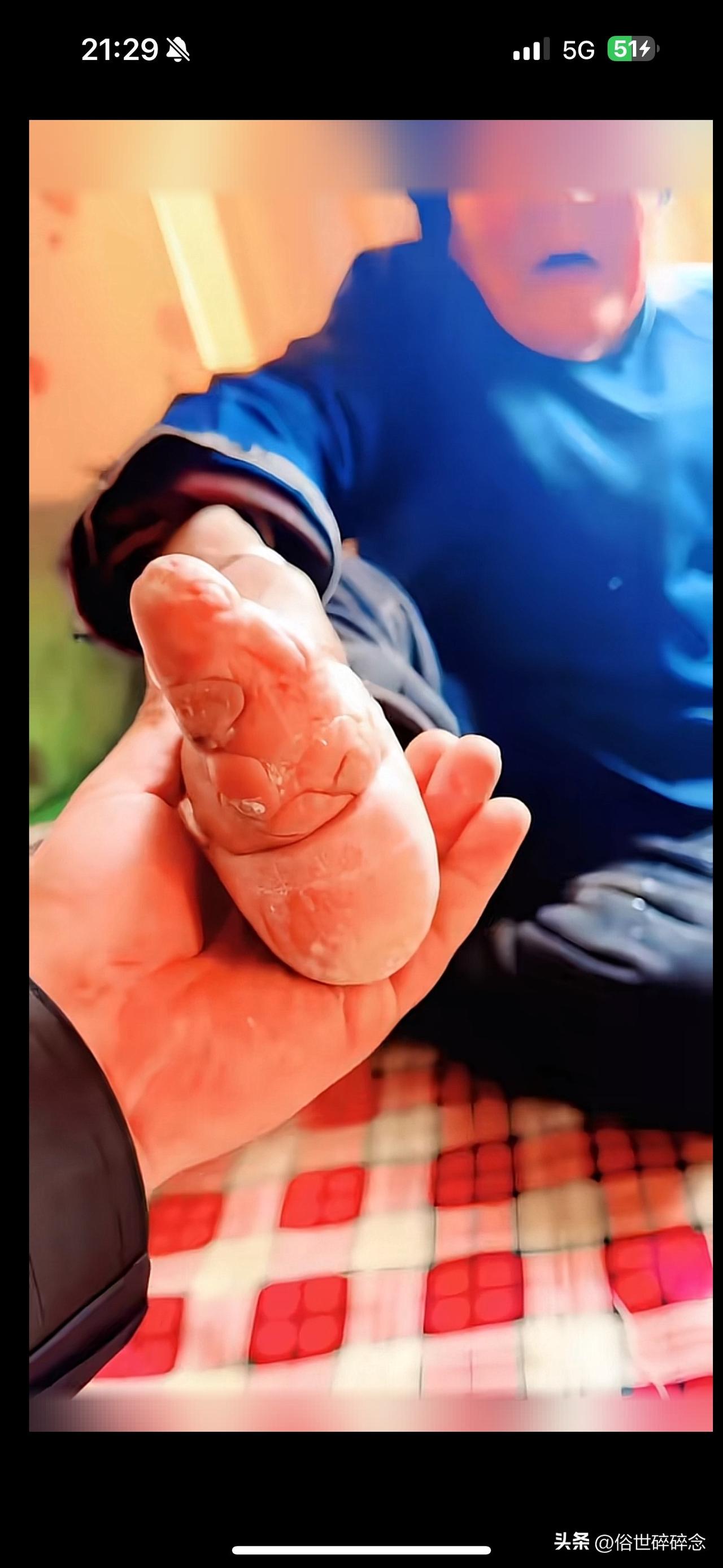 旧时的三寸金莲到底承受了多少痛苦？看完满是心酸
实拍老一辈裹过脚的脚掌，骨骼变形