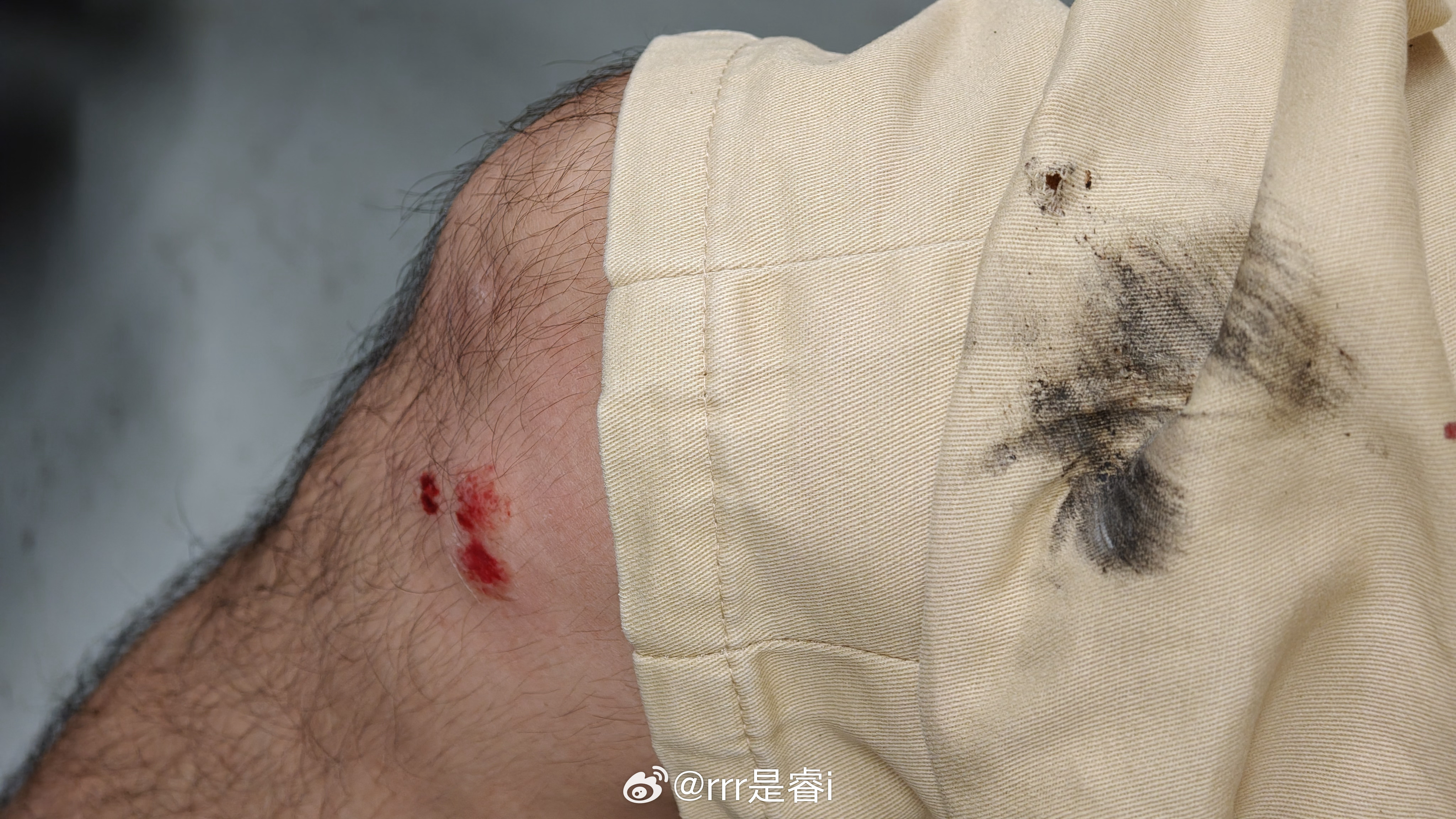 真的不知道招惹谁了什么坏事都要缠上我… 