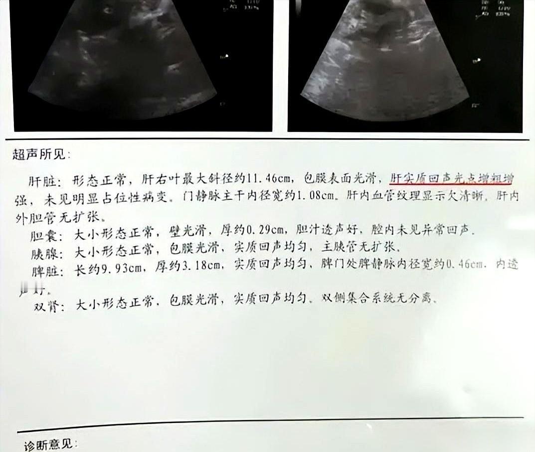 门诊室里，最怕空气突然安静。
一个大哥，攥着两张报告单，指节都发白了。一张是病毒