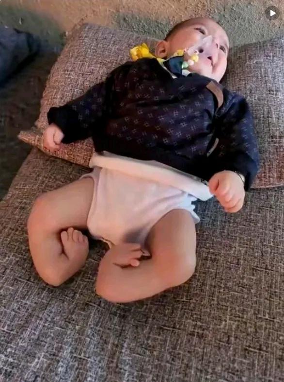 新生儿出现这样的重度残疾情况，医院的产检有没有责任，算不算医疗事故。产妇可不可以