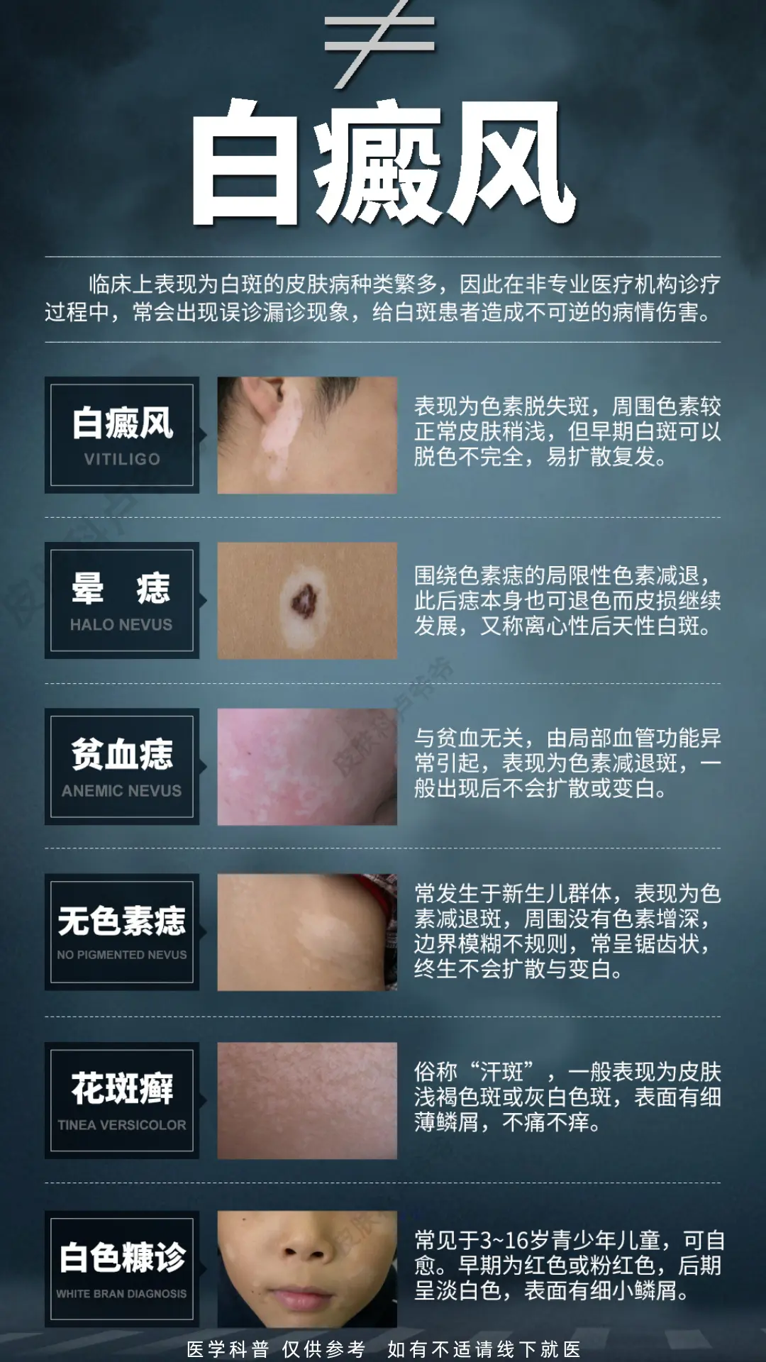 医学科普 白癜风 白斑 硬核健康科普行动  知识分享