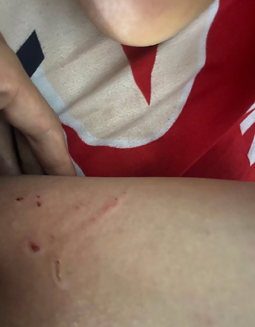 网友求助：女朋友喜欢咬我怎么办 ​​​