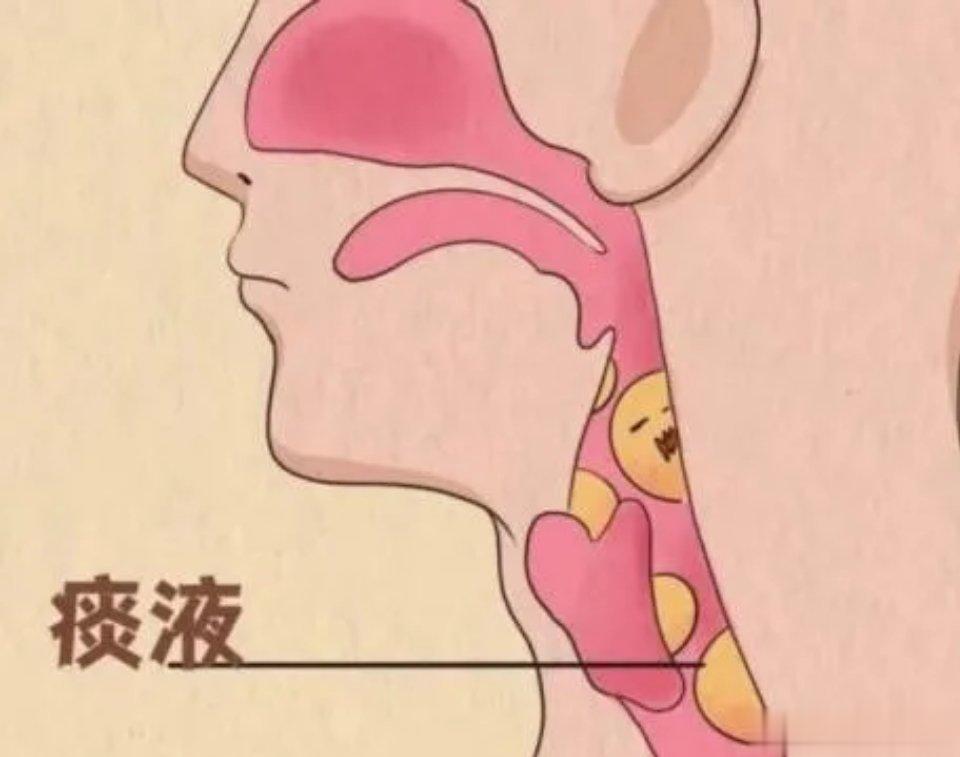 感染新冠后咳嗽一直不好，到底要不要用抗生素？最近“二阳”的人增多，后台关于“二阳