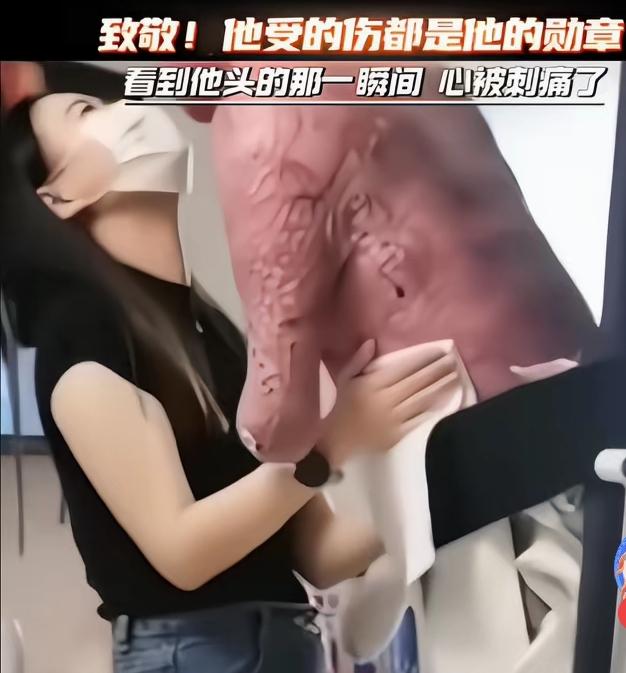 消防员刘攀在执行任务时全身93%重度烧伤，不幸截肢。他以血肉之躯逆行向前，用生命