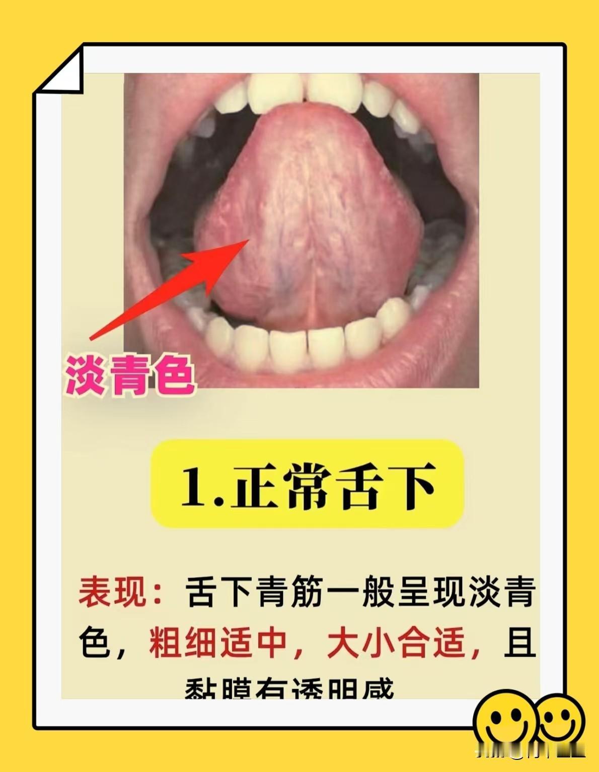 伸舌头我来看！一个也不漏！身体有无血瘀，看看舌下就知道！