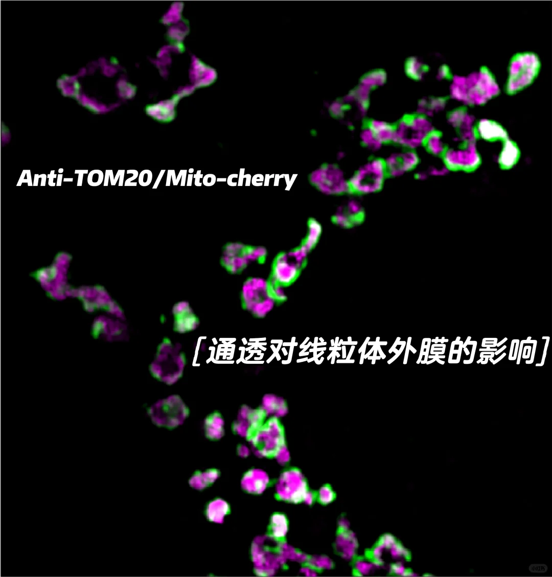 免疫荧光固定通透条件对线粒体染色影响