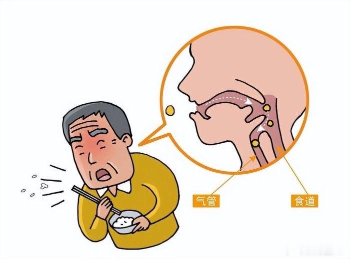 别把“噎食梗阻”等闲视之：吞咽不适背后的食管健康警示·默斋主人原创科普散文不少人