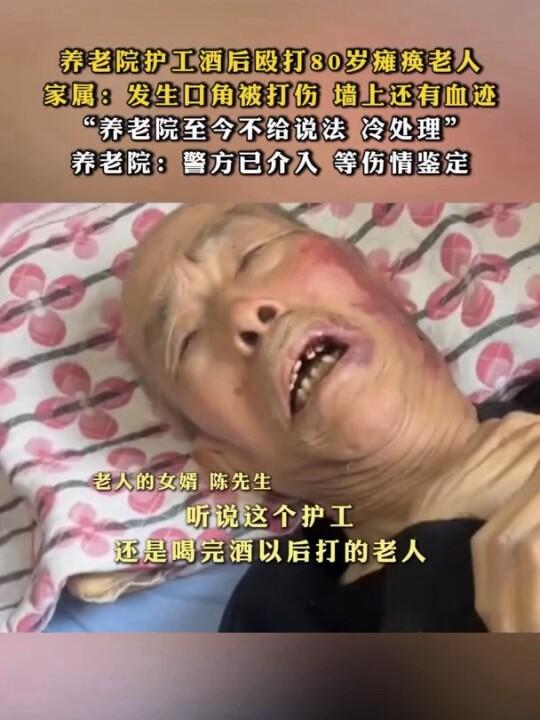 天津南开区纳德养老公寓曝出恶性事件，一名80岁瘫痪老人遭酒后护工殴打，家属控诉院