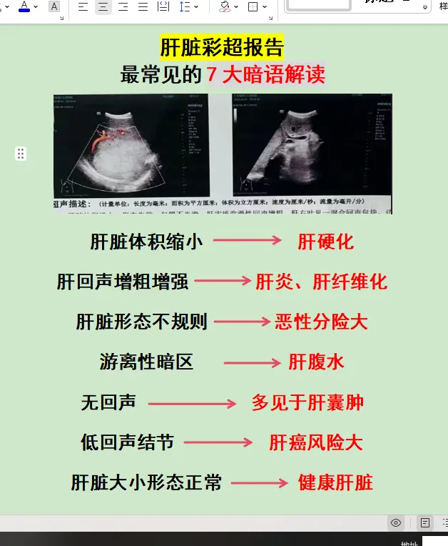 乙肝 肝硬化 肝脏彩超 健康科普 肝病教授陈士俊