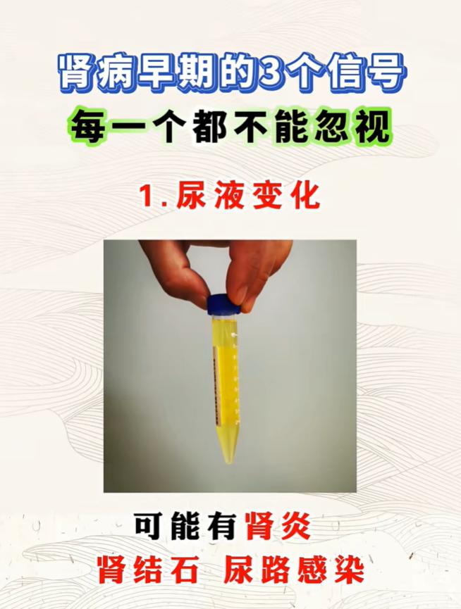 腿脚浮肿、小便泡沫不散，警惕肾脏早期损伤
