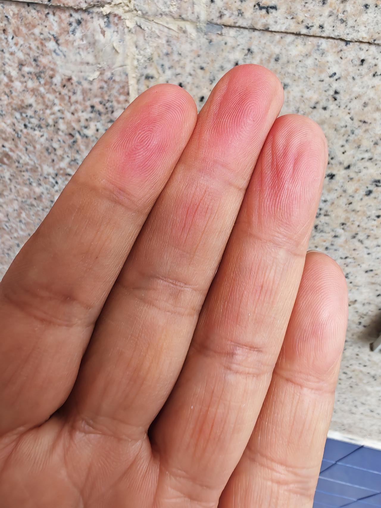 中医可以自学吗？前两年看到倪海厦的中医教学视频，心中一热就开始了自学中医的进程。