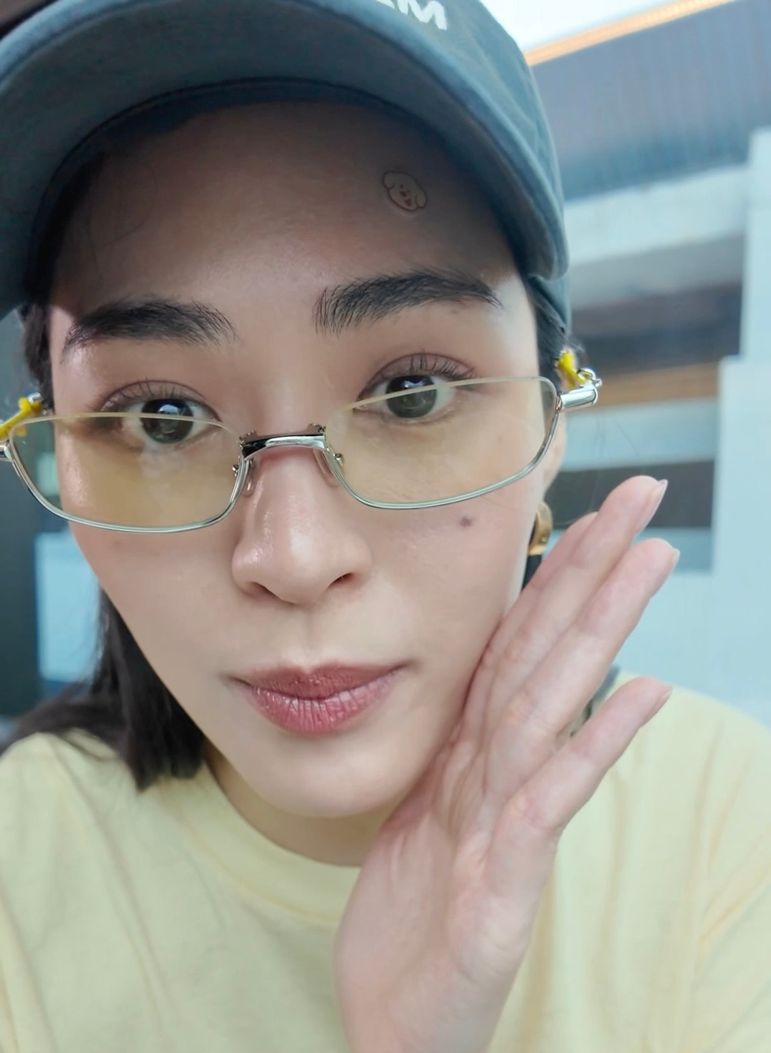 小狗脸上贴痘痘贴，天下第一萌邝玲玲