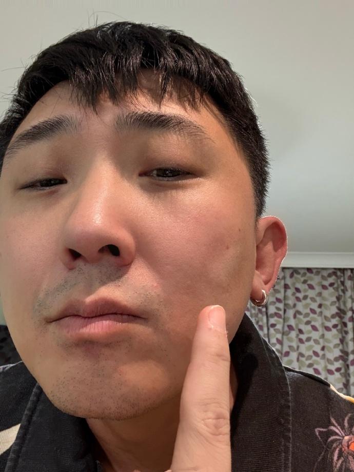 尚九熙在英国伦敦遭遇抢劫，挨了一拳，脸肿了，好在钱包抢回来了。来欧洲的次数多了，