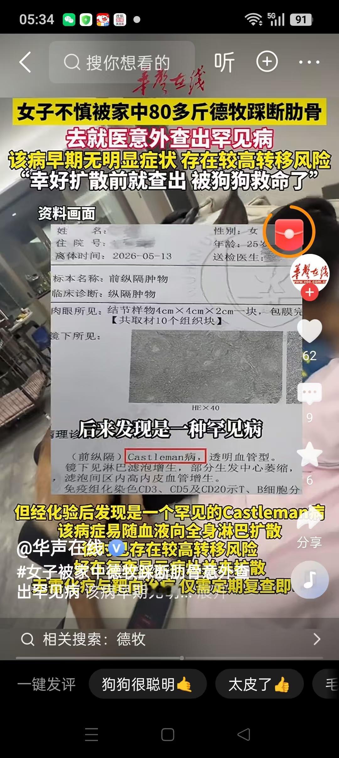现在网上只要出现大型犬相关新闻，很多人第一反应就是禁养、一刀切，觉得大狗天生危险