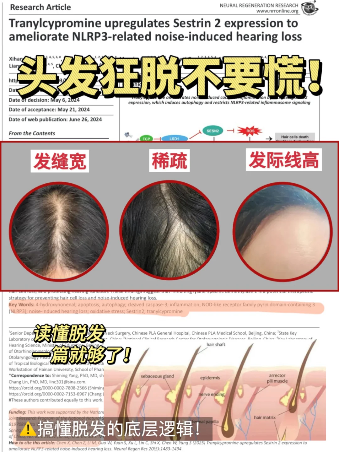 聪明人都知道！防脱从调理头皮环境开始
