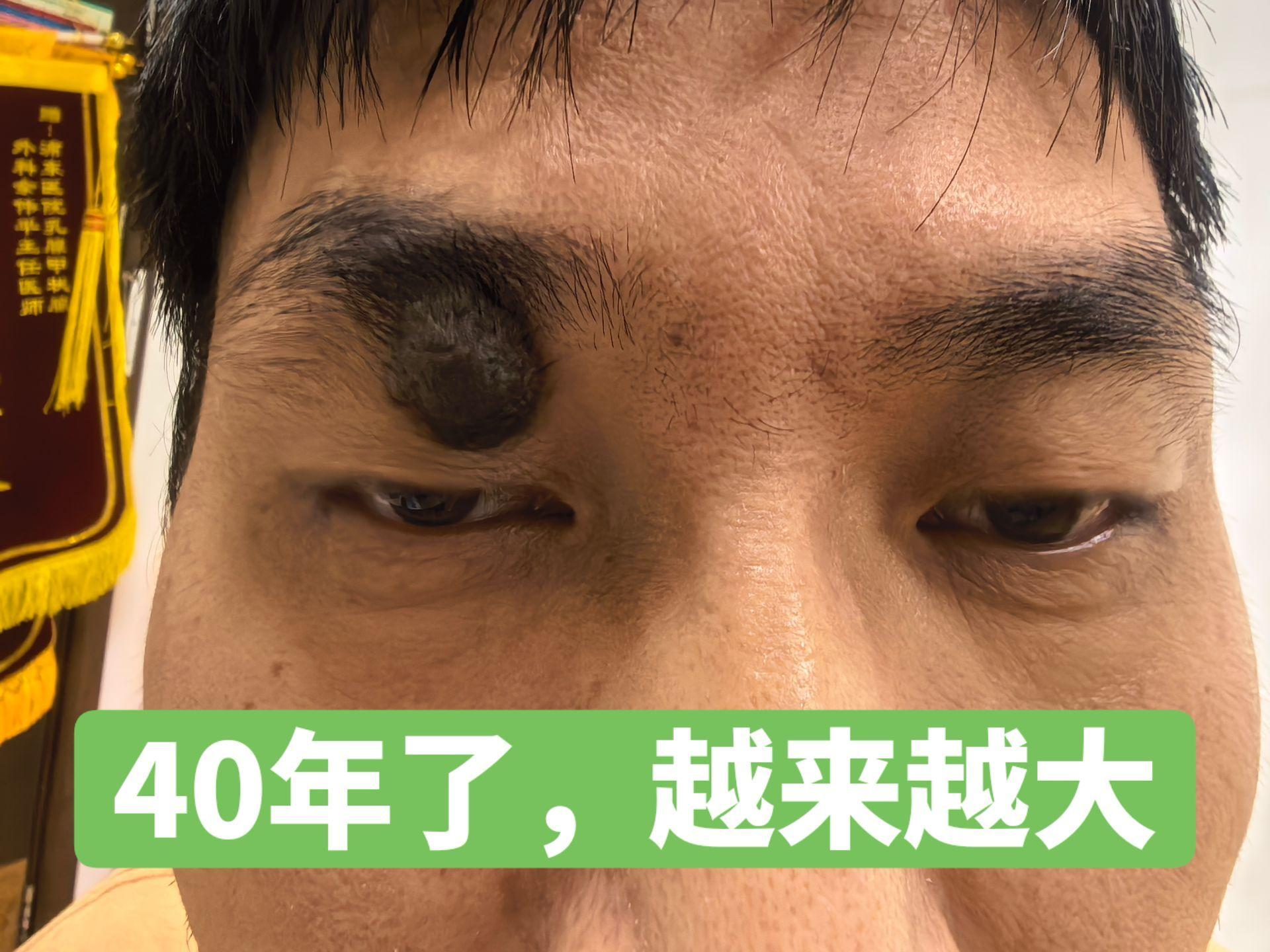 做完美容手术，麻烦问题变完美✨ 之前一直困扰的麻烦问题，做完手术后居然...