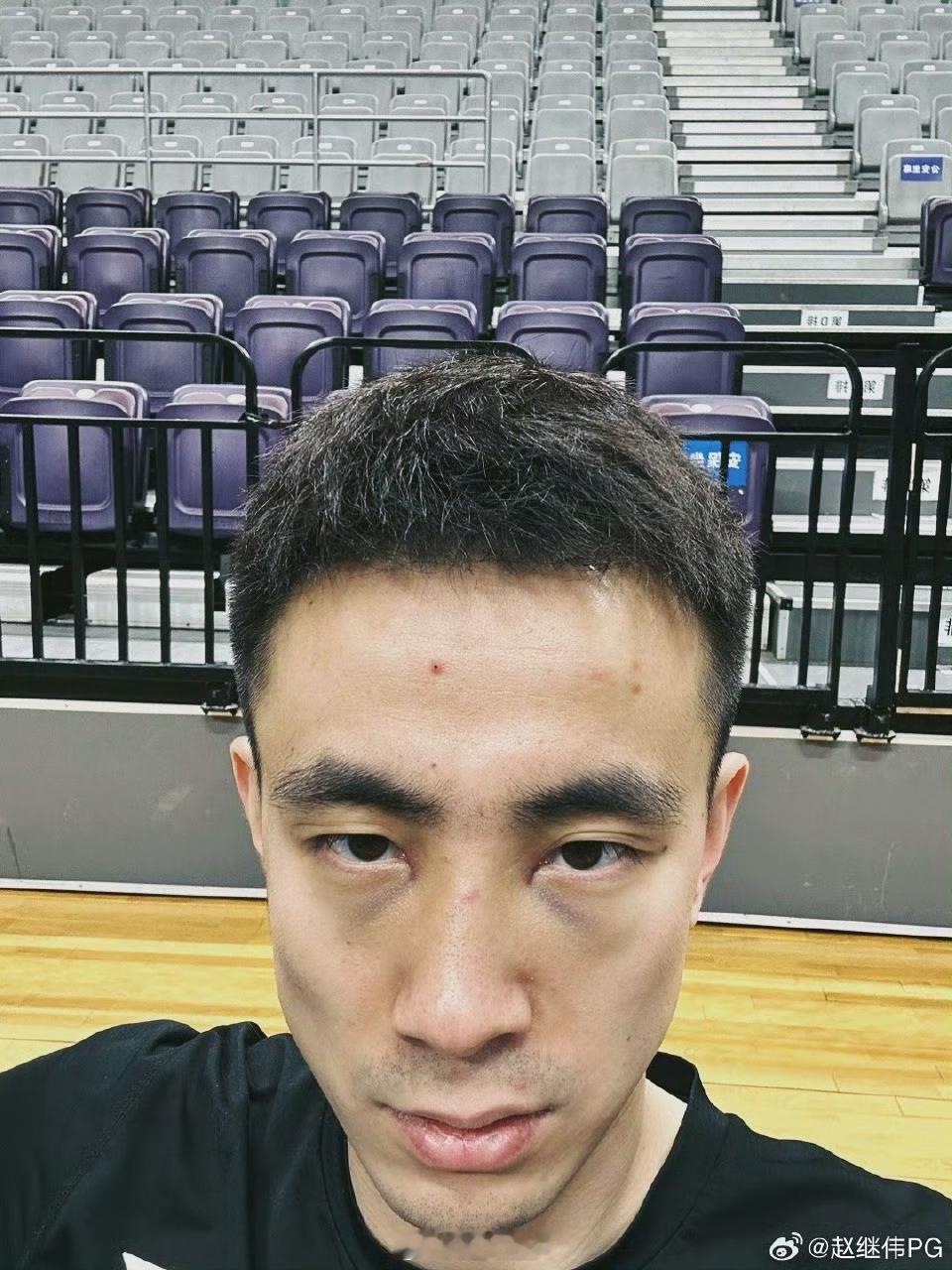 心疼咱家帅小伙 ​​​