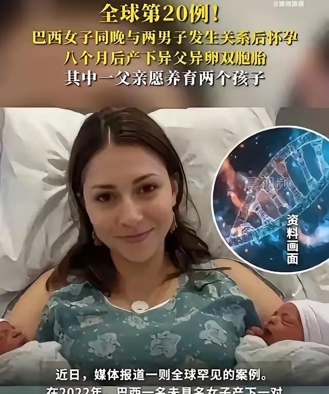 全球仅20例！巴西女子同一晚与2名男子发生了关系。不久后，女子后怀孕了，并且还生